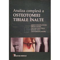 Analiza complexa a osteotomiei tibiale inalte