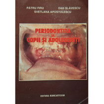 Periodontita la copii si adolescenti