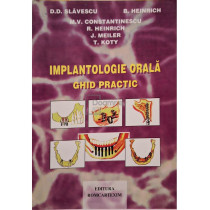 Implantologie orala - Ghid practic