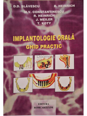 D. D. Slavescu - Implantologie orala - Ghid practic - 1998 - Brosata