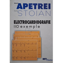 Electrocardiografie - 110 exemple