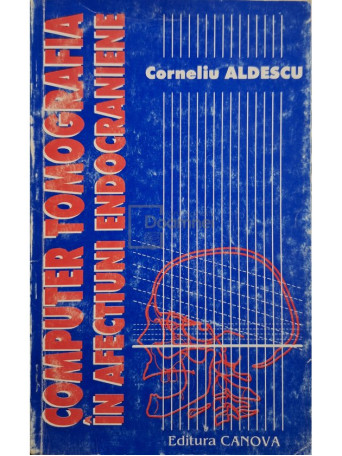 Corneliu Aldescu - Computer tomografia in afectiuni endocraniene - 1995 - Brosata