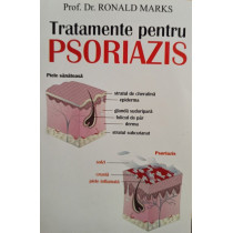 Tratamente pentru psoriazis