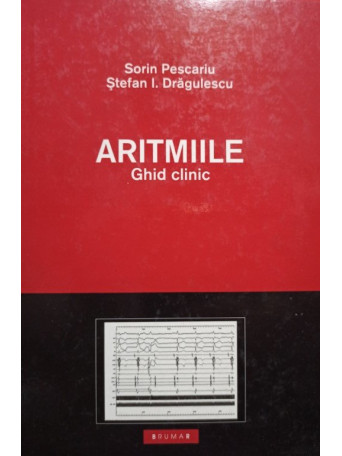 Aritmiile - Ghid clinic