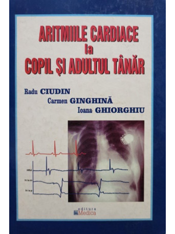 Aritmiile cardiace la copil si adultul tanar