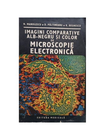 Imagini comparative alb-negru si color de microscopie electronica (semnata)