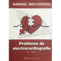 Probleme de electrocardiografie