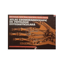 Atlas cromoradiografic de patologie osteoarticulara