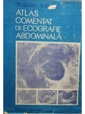 Atlas comentat de ecografie abdominala