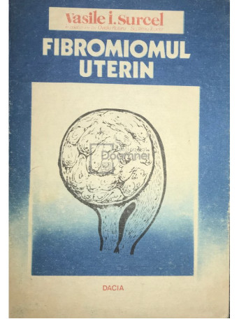 Fibromiomul uterin