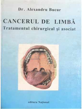 Cancerul de limba. Tratamentul chirurgical si asociat