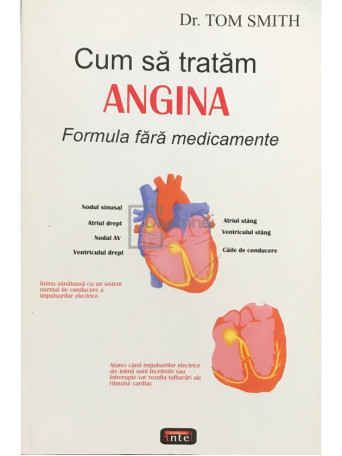 Cum sa tratam angina