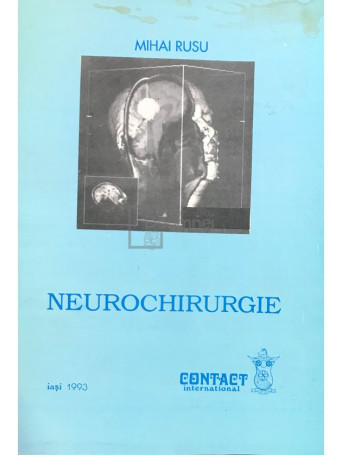 Neurochirurgie