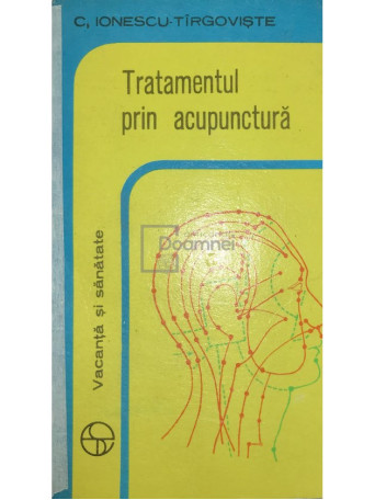 Tratamentul prin acupunctura