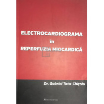 Electrocardiograma in reperfuzia miocardica