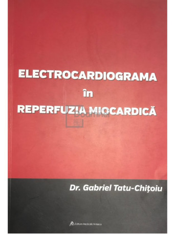 Electrocardiograma in reperfuzia miocardica