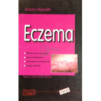 Eczema