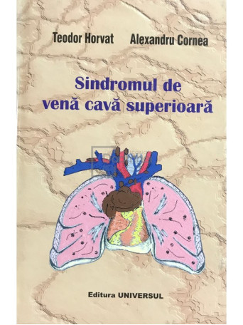 Sindromul de vena cava superioara