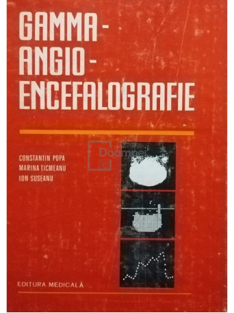 Gamma-angio-encefalografie