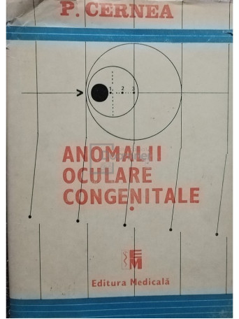 Anomalii oculare congenitale