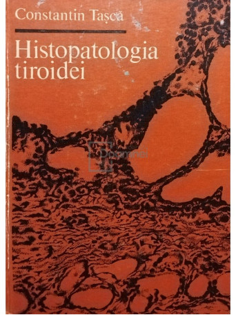 Histopatologia tiroidei