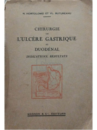 Chirurgie de l'ulcere gastrique et duodenal