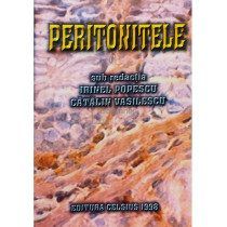 Peritonitele