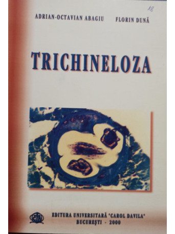 Trichineloza