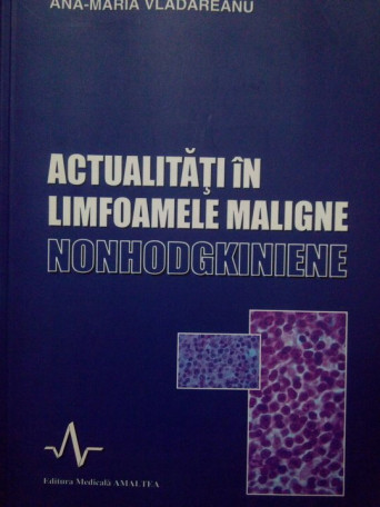 Maria Vladareanu - Actualitati in limfoamele maligne nonhodgkiniene