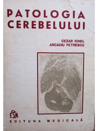 Patologia cerebelului