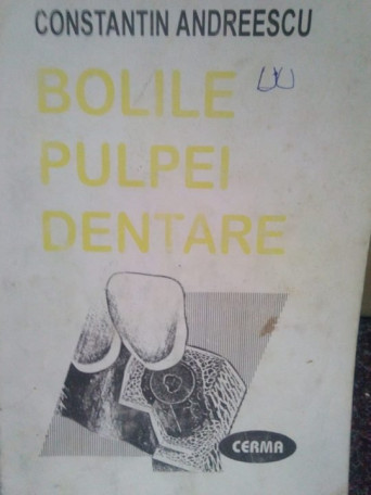 Bolile pulpei dentare