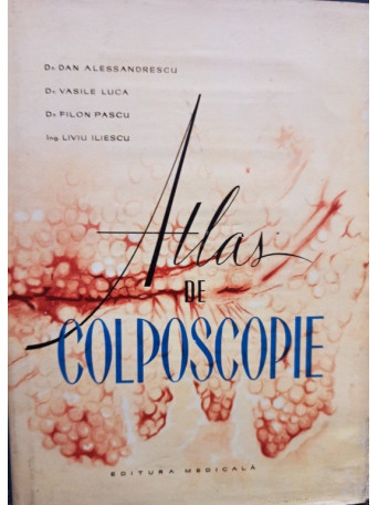 Atlas de colposcopie