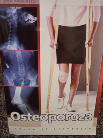 Osteoporoza - cauze si prevenire