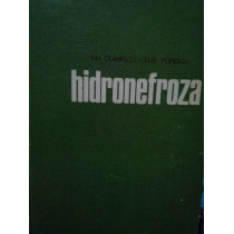 Hidronefroza