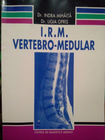 I. R. M. vertebromedular