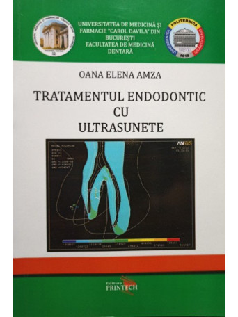 Tratamentul endodontic cu ultrasunete