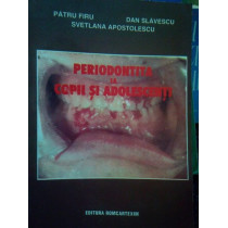 Periodontita la copii si adolescenti