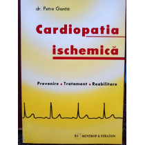 Cardiopatia ischemica