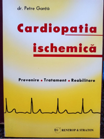 Cardiopatia ischemica