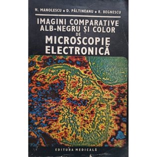 Imagini comparative alb-negru si color de microscopie electronica (semnata)