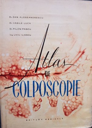 Atlas de colposcopie
