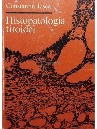 Histopatologia tiroidei