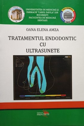Tratamentul endodontic cu ultrasunete