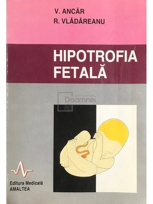 Hipotrofia fetală