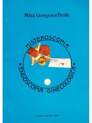 Histeroscopia - Endoscopia ginecologica