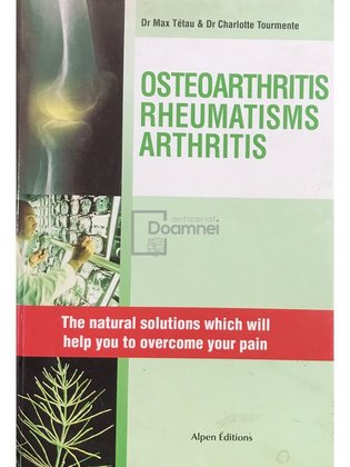 Osteoarthritis. Rheumatism. Arthritis