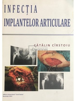 Infectia implantelor articulare