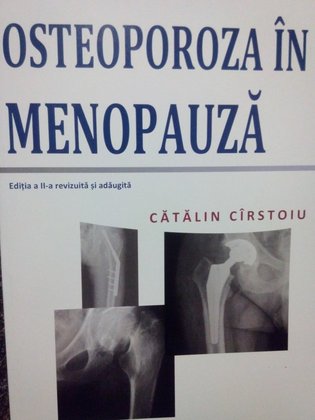 Osteoporoza in menopauza