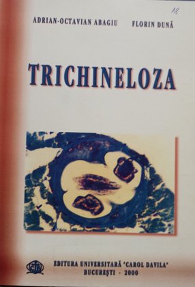Trichineloza
