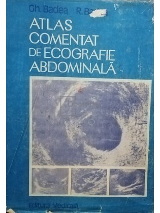 Atlas comentat de ecografie abdominală